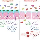les altérations intestinales associées au diabète type 1 sont associées à l'inflammation de la muqueuse
