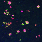 Maladie d'Alzheimer: perturbations synaptiques autour des plaques amyloïdes